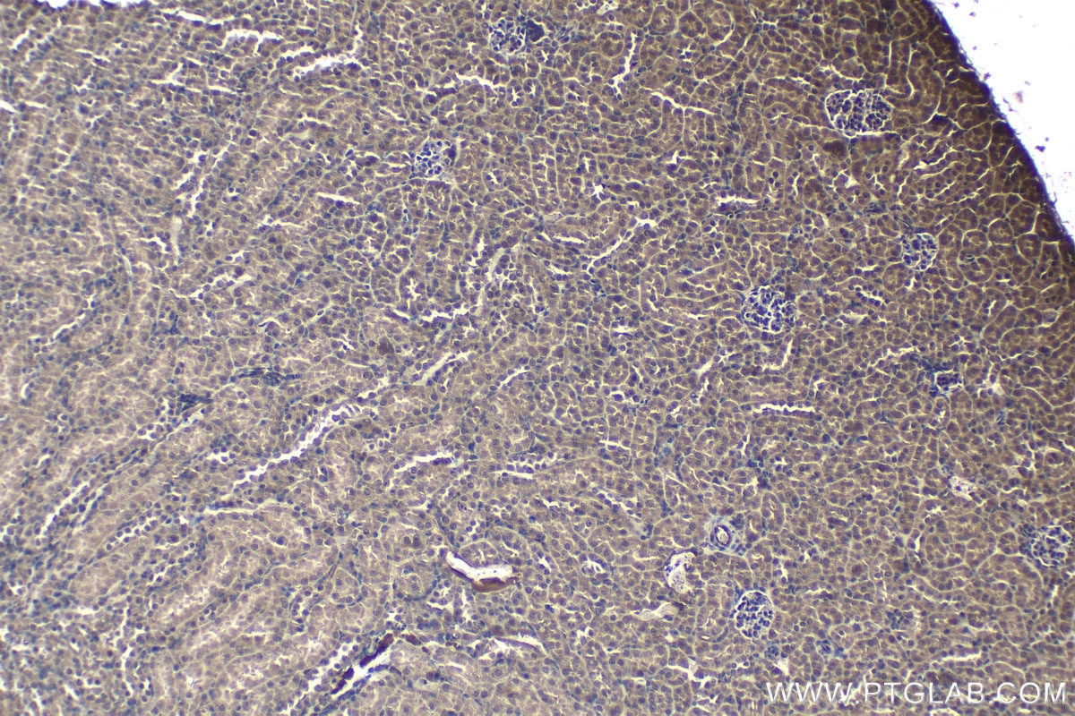 Immunohistochemical analysis of paraffin-embedded mouse kidney tissue slide using KHC1157 (TRAF6 IHC Kit).