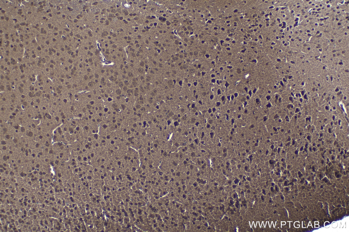 Immunohistochemical analysis of paraffin-embedded mouse brain tissue slide using KHC1157 (TRAF6 IHC Kit).