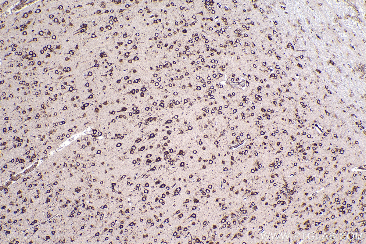 Immunohistochemical analysis of paraffin-embedded rat brain tissue slide using KHC2264 (TRAPA/SSR1 IHC Kit).