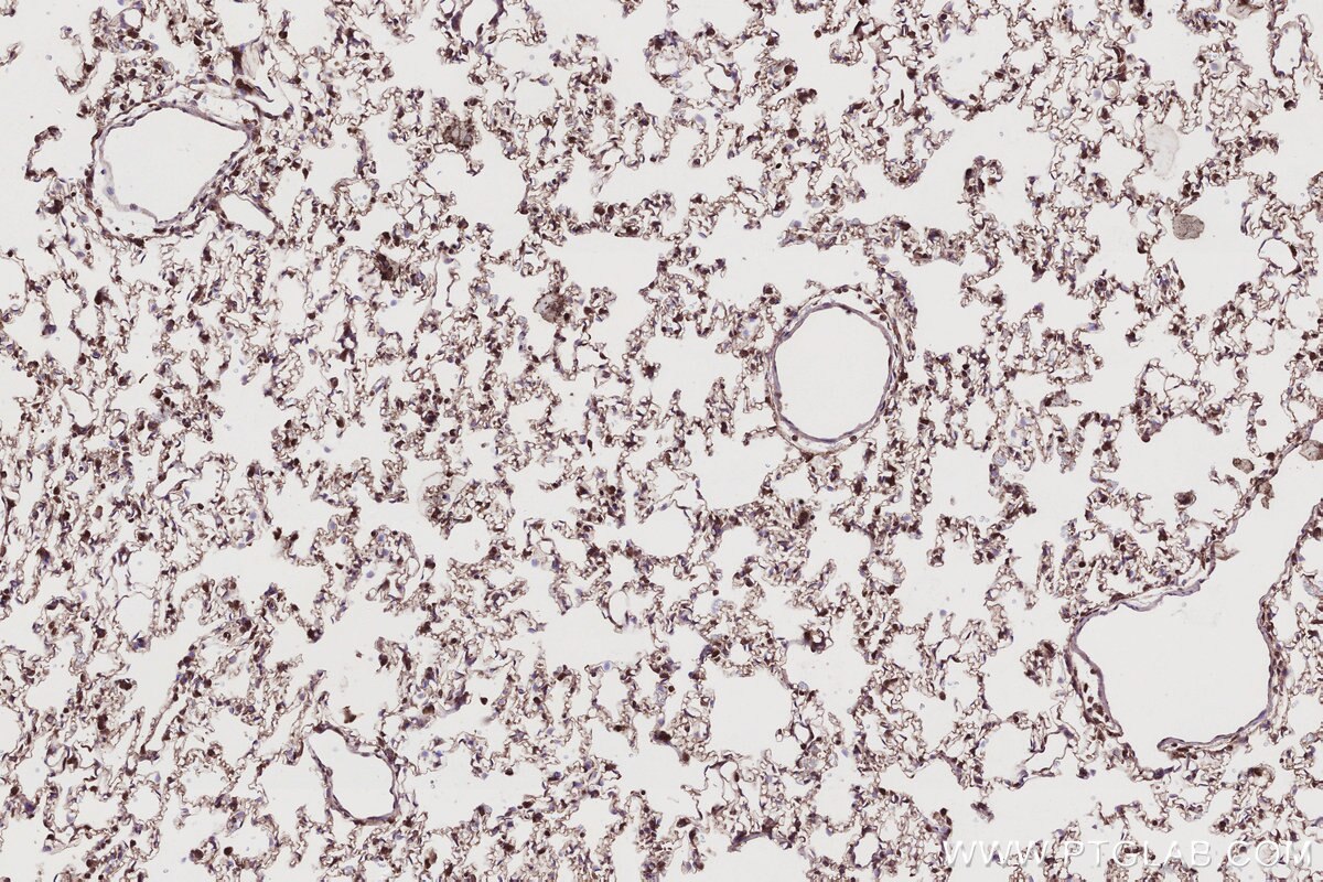 Immunohistochemical analysis of paraffin-embedded rat lung tissue slide using KHC2790 (TRIM11 IHC Kit).