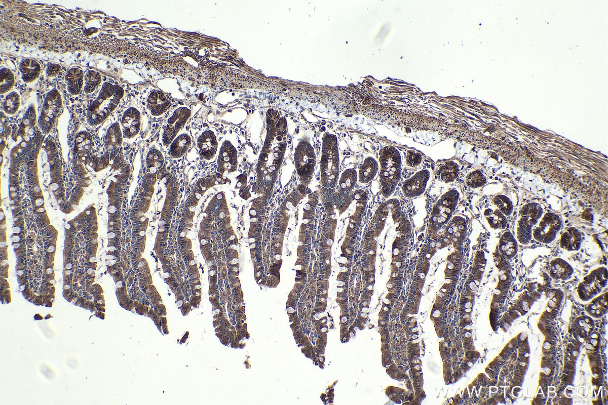 Immunohistochemical analysis of paraffin-embedded rat small intestine tissue slide using KHC1914 (TRIM15 IHC Kit).