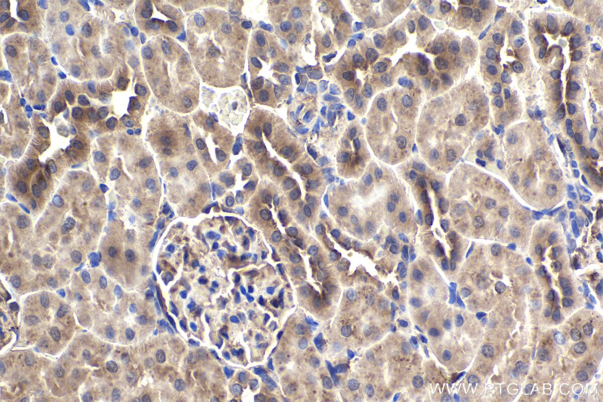 Immunohistochemical analysis of paraffin-embedded rat kidney tissue slide using KHC1914 (TRIM15 IHC Kit).