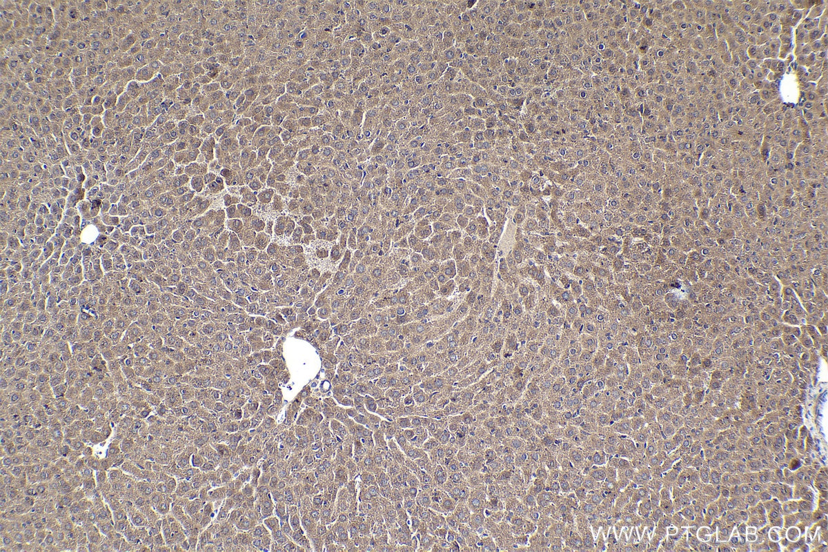 Immunohistochemical analysis of paraffin-embedded mouse liver tissue slide using KHC1914 (TRIM15 IHC Kit).