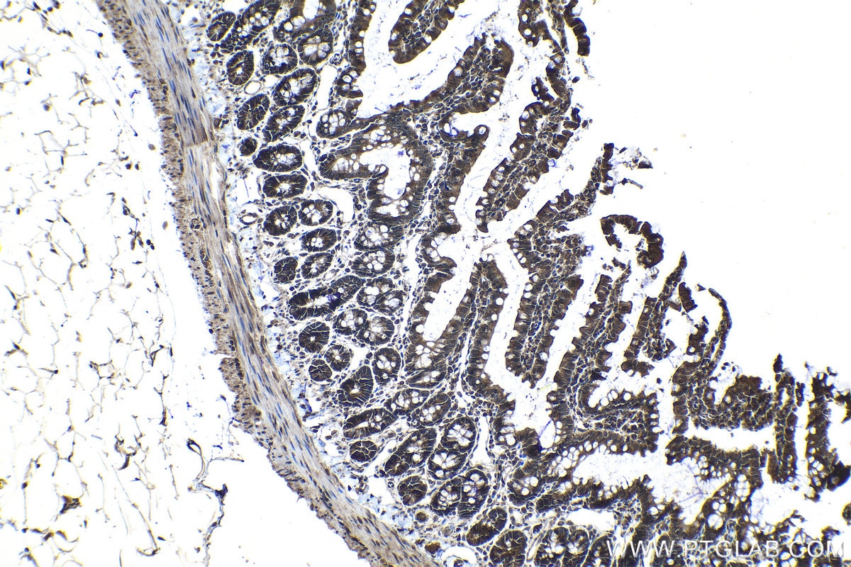 Immunohistochemical analysis of paraffin-embedded rat small intestine tissue slide using KHC1175 (TRIM16 IHC Kit).