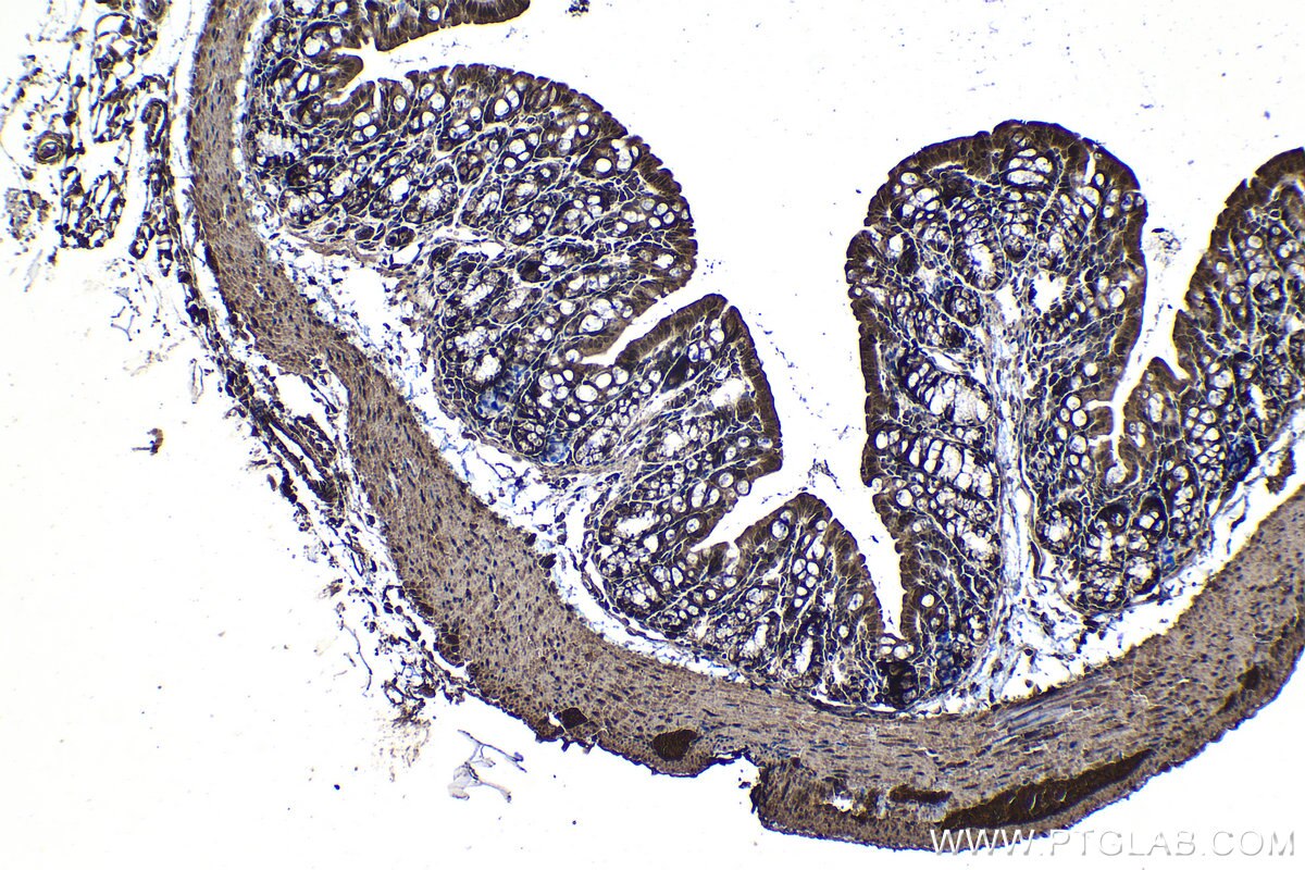 Immunohistochemical analysis of paraffin-embedded mouse colon tissue slide using KHC1177 (TRIM21 IHC Kit).