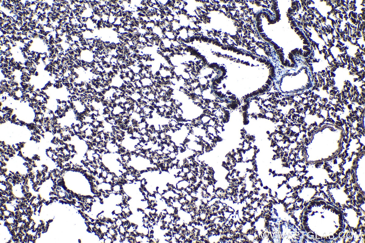 Immunohistochemical analysis of paraffin-embedded mouse lung tissue slide using KHC1177 (TRIM21 IHC Kit).