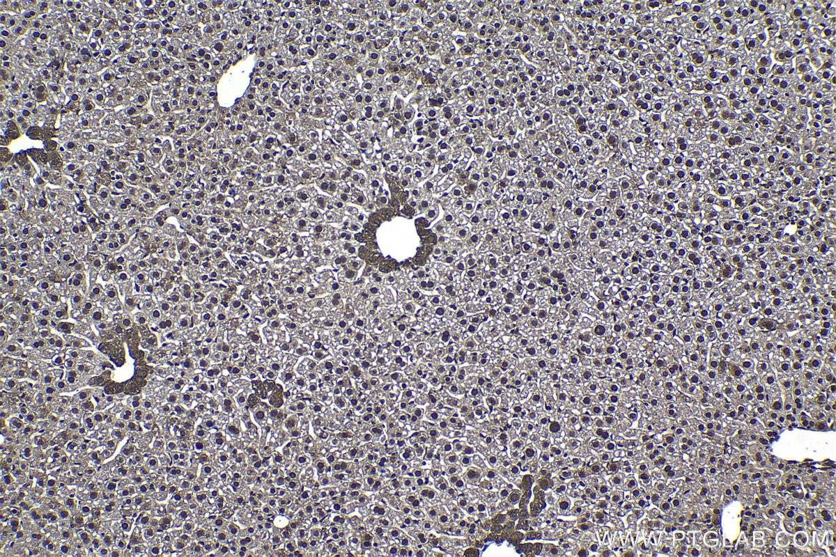 Immunohistochemical analysis of paraffin-embedded mouse liver tissue slide using KHC1176 (TRIM24 IHC Kit).
