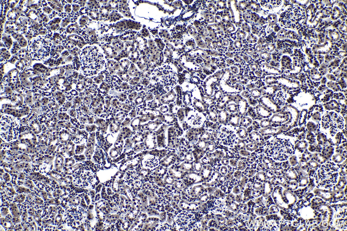 Immunohistochemical analysis of paraffin-embedded rat kidney tissue slide using KHC1176 (TRIM24 IHC Kit).