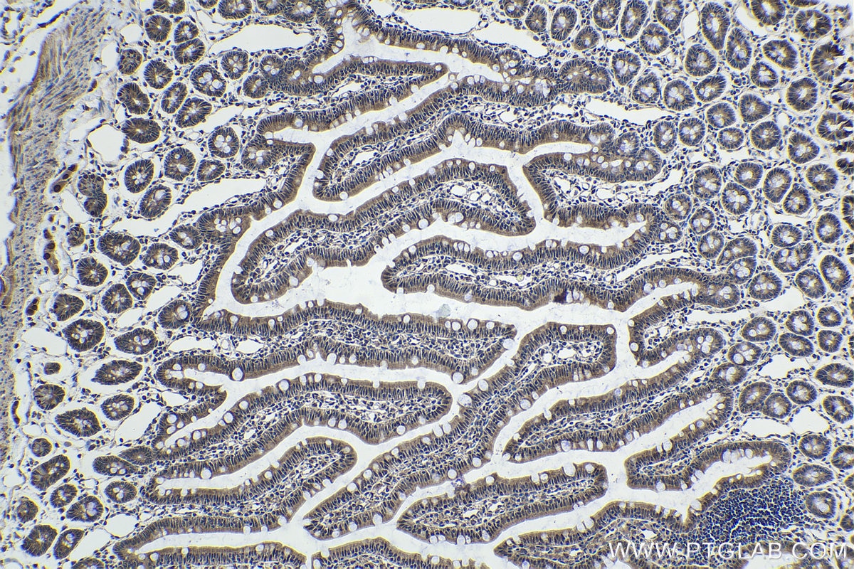 Immunohistochemical analysis of paraffin-embedded rat small intestine tissue slide using KHC1729 (TRIM25 IHC Kit).