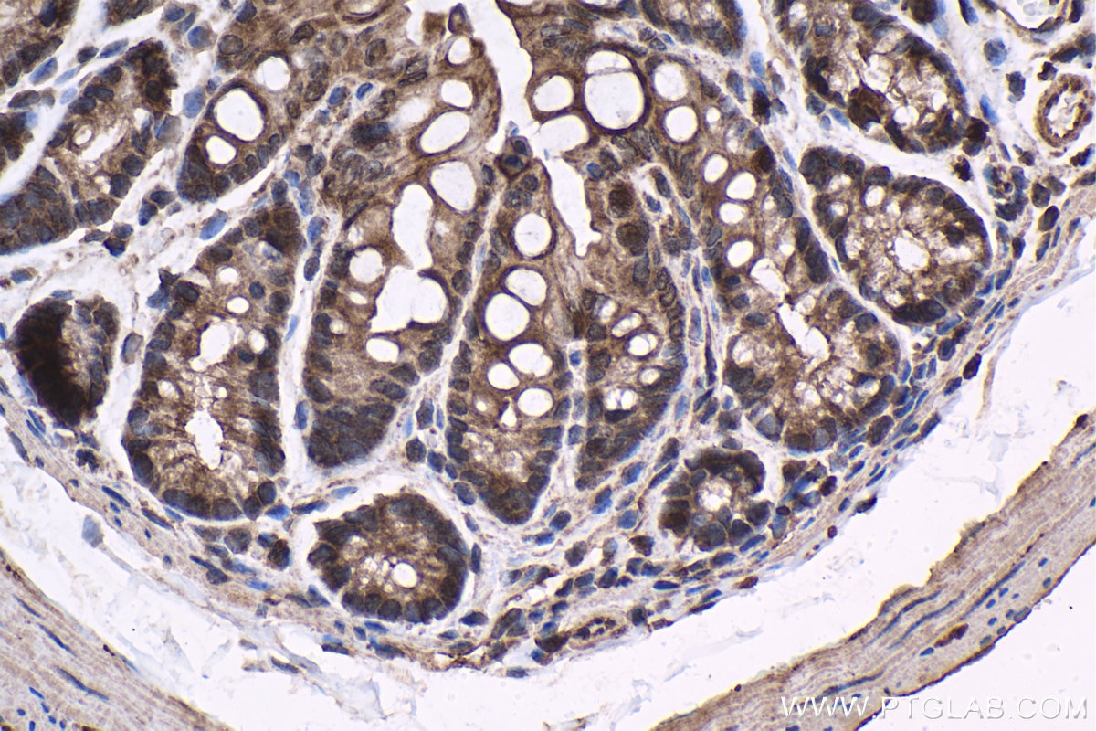 Immunohistochemical analysis of paraffin-embedded mouse colon tissue slide using KHC1532 (TRIM27 IHC Kit).