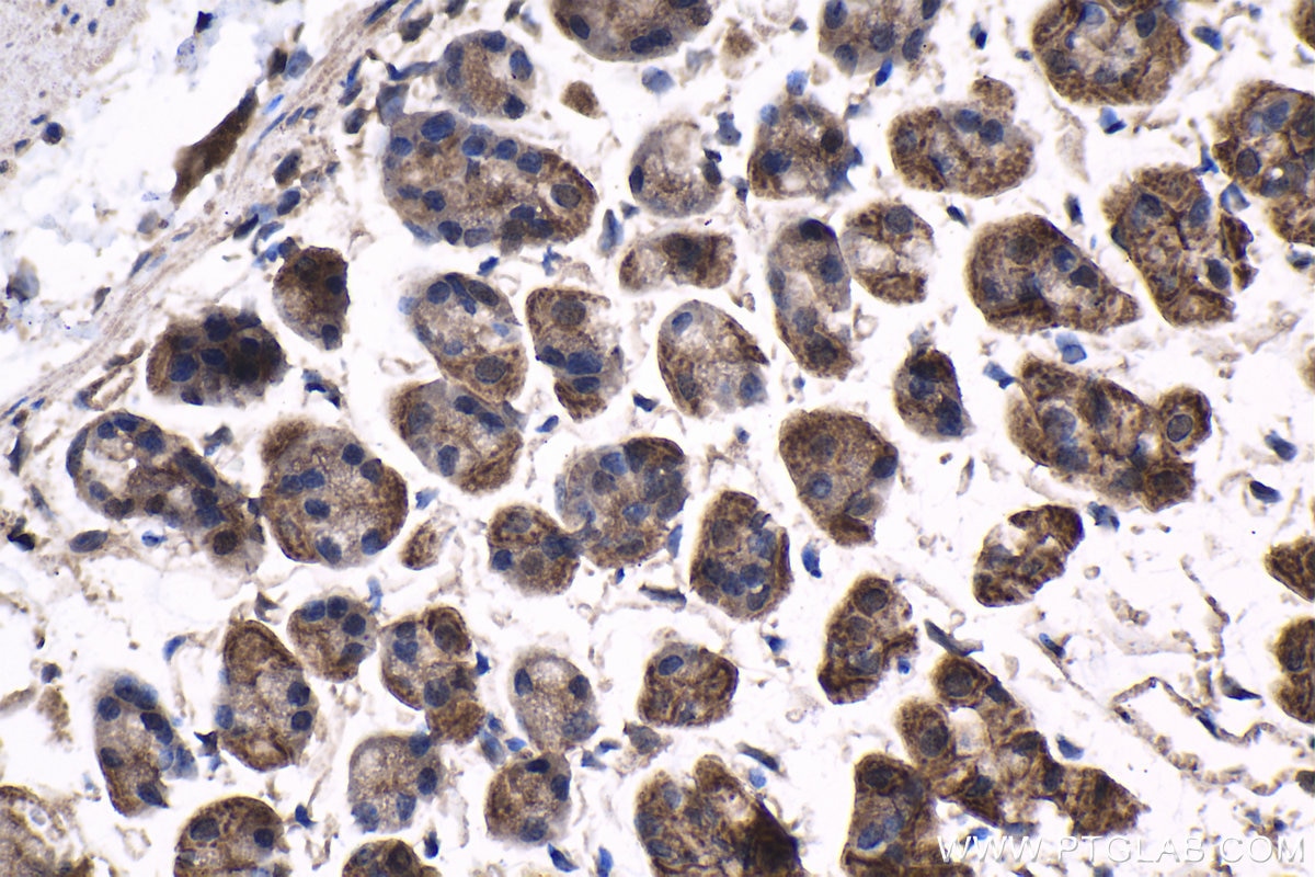 Immunohistochemical analysis of paraffin-embedded mouse stomach tissue slide using KHC1532 (TRIM27 IHC Kit).