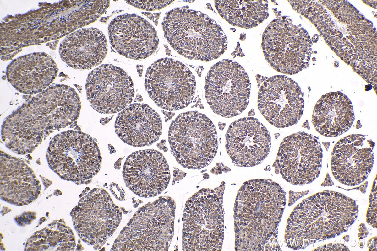 Immunohistochemical analysis of paraffin-embedded mouse testis tissue slide using KHC1532 (TRIM27 IHC Kit).