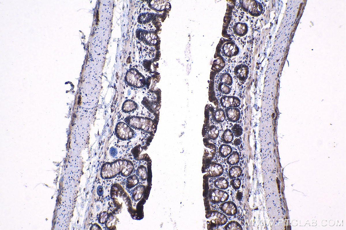 Immunohistochemical analysis of paraffin-embedded rat colon tissue slide using KHC1532 (TRIM27 IHC Kit).