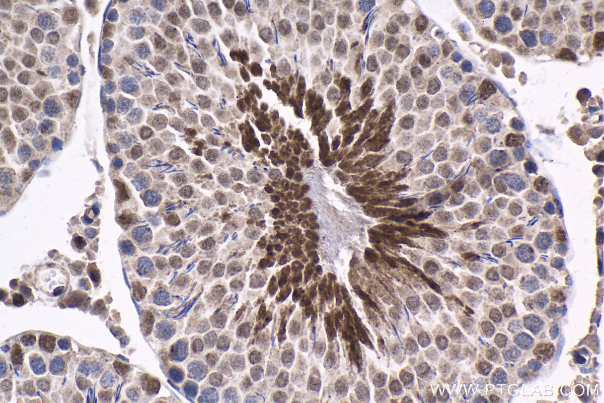 Immunohistochemical analysis of paraffin-embedded rat testis tissue slide using KHC1532 (TRIM27 IHC Kit).