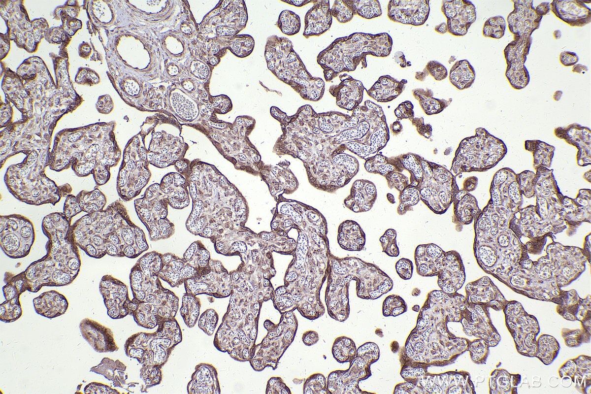 Immunohistochemical analysis of paraffin-embedded human placenta tissue slide using KHC2446 (TRIM29 IHC Kit).