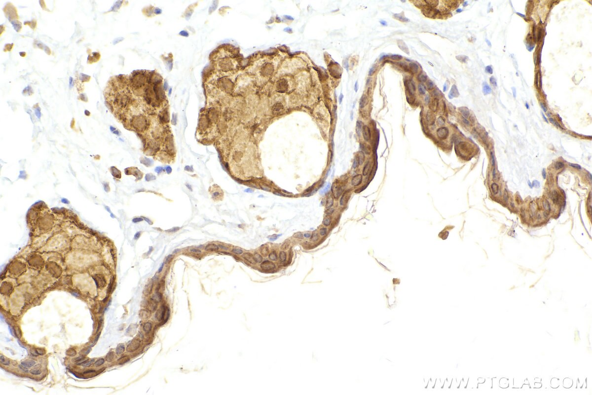 Immunohistochemical analysis of paraffin-embedded mouse skin tissue slide using KHC2446 (TRIM29 IHC Kit).