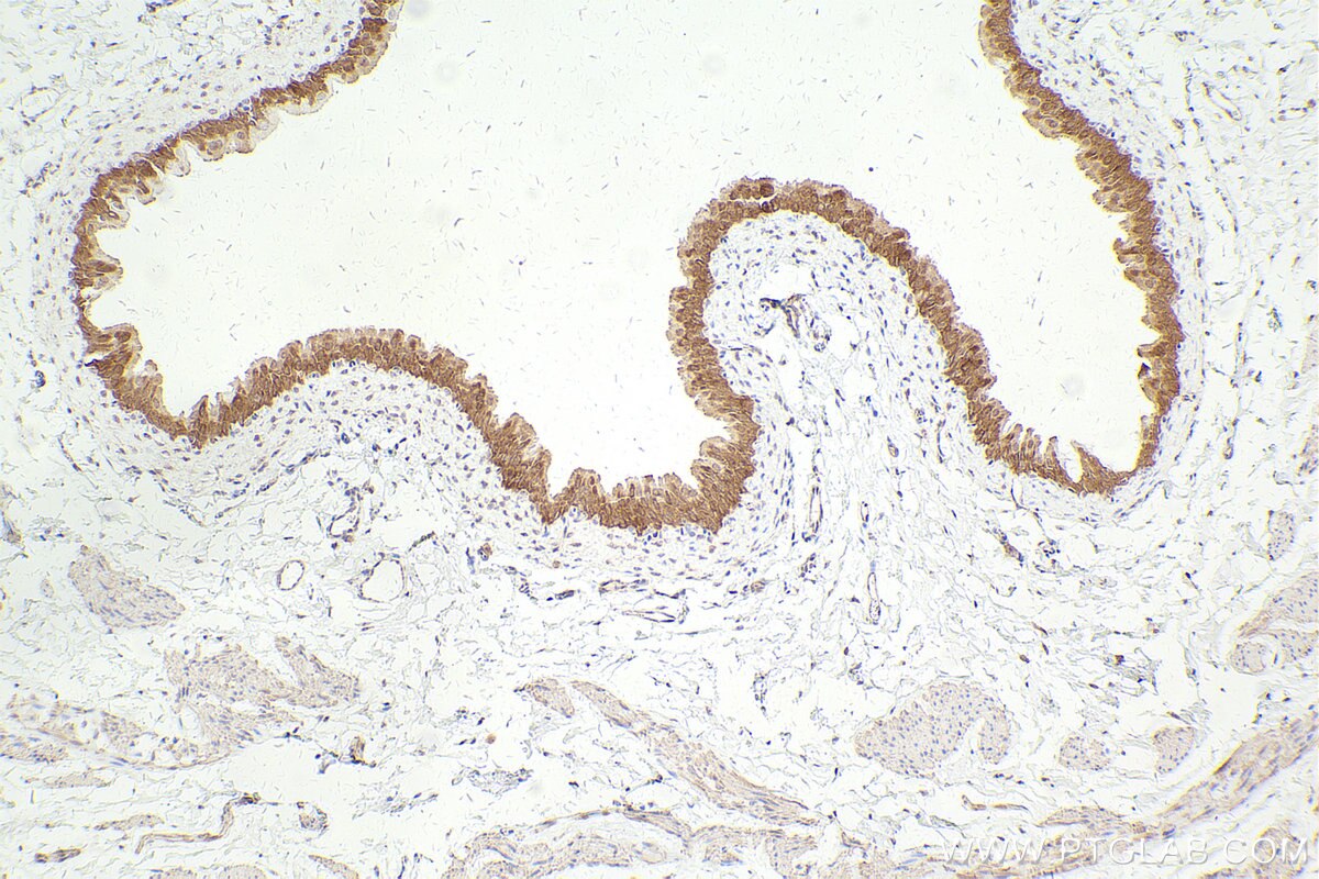 Immunohistochemical analysis of paraffin-embedded rat bladder tissue slide using KHC2446 (TRIM29 IHC Kit).