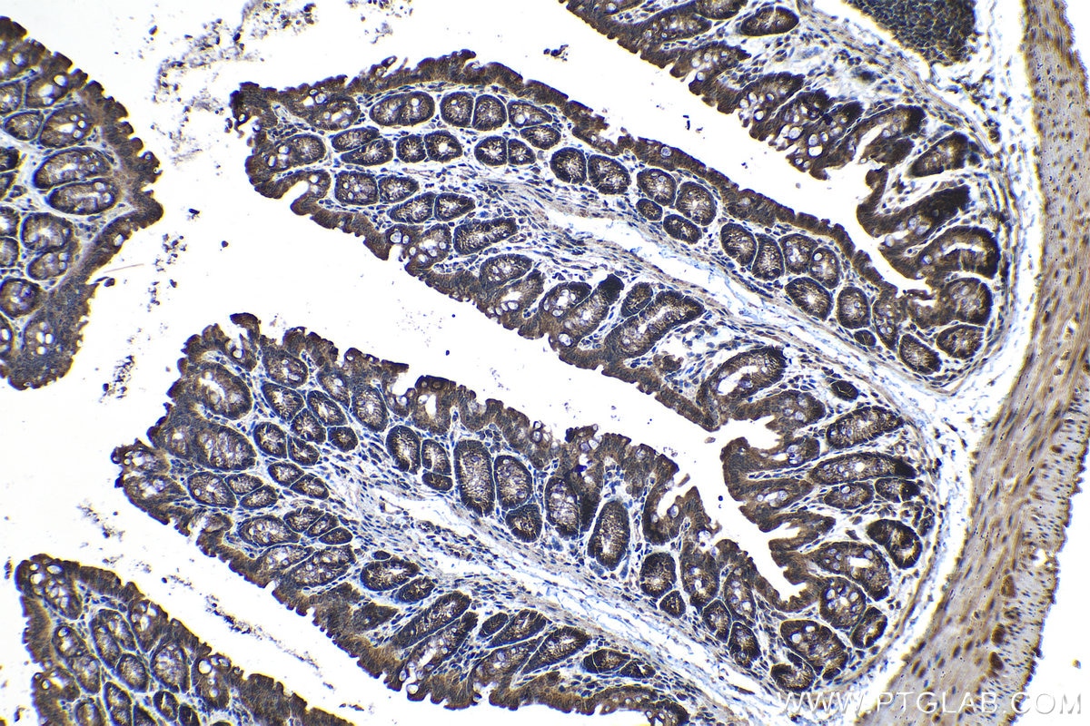 Immunohistochemical analysis of paraffin-embedded mouse colon tissue slide using KHC1179 (TRIM32 IHC Kit).