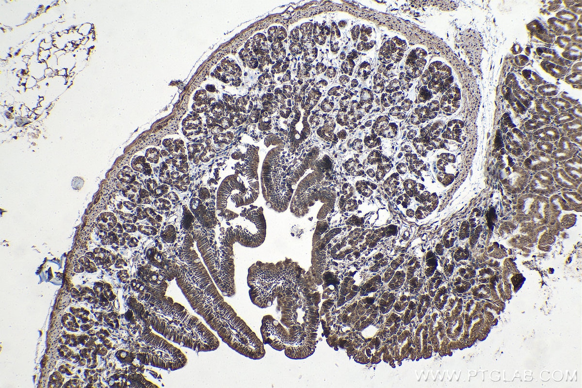 Immunohistochemical analysis of paraffin-embedded mouse stomach tissue slide using KHC1179 (TRIM32 IHC Kit).