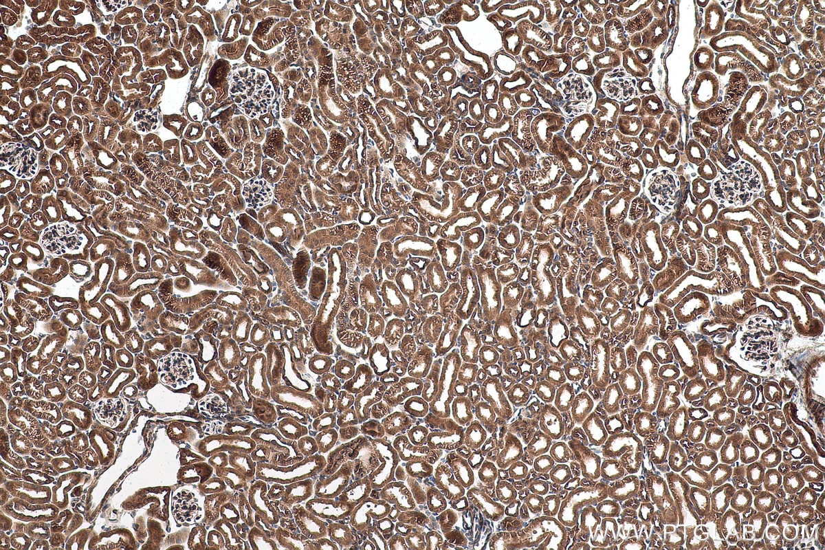 Immunohistochemical analysis of paraffin-embedded mouse kidney tissue slide using KHC0966 (TRIM47 IHC Kit).