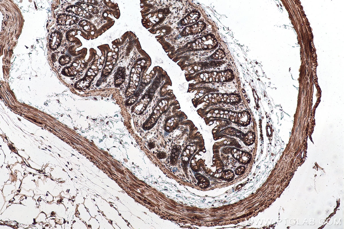 Immunohistochemical analysis of paraffin-embedded rat colon tissue slide using KHC0966 (TRIM47 IHC Kit).