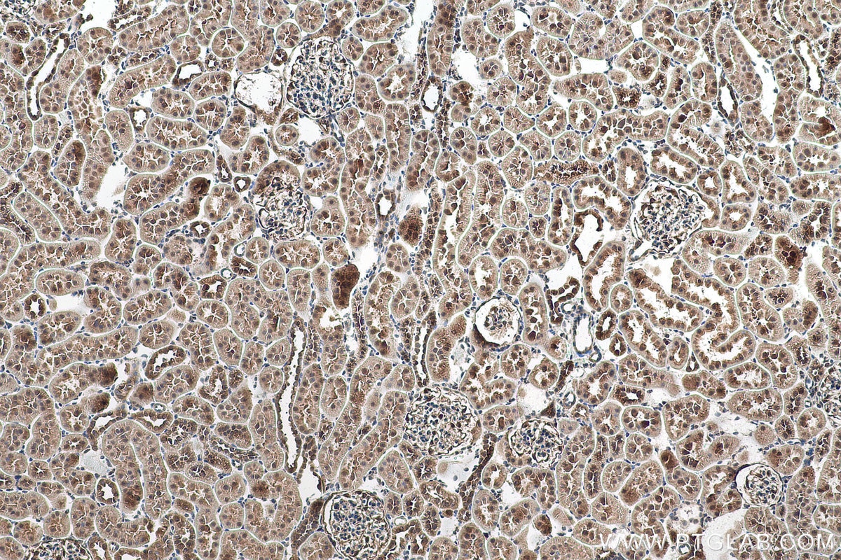 Immunohistochemical analysis of paraffin-embedded rat kidney tissue slide using KHC0966 (TRIM47 IHC Kit).