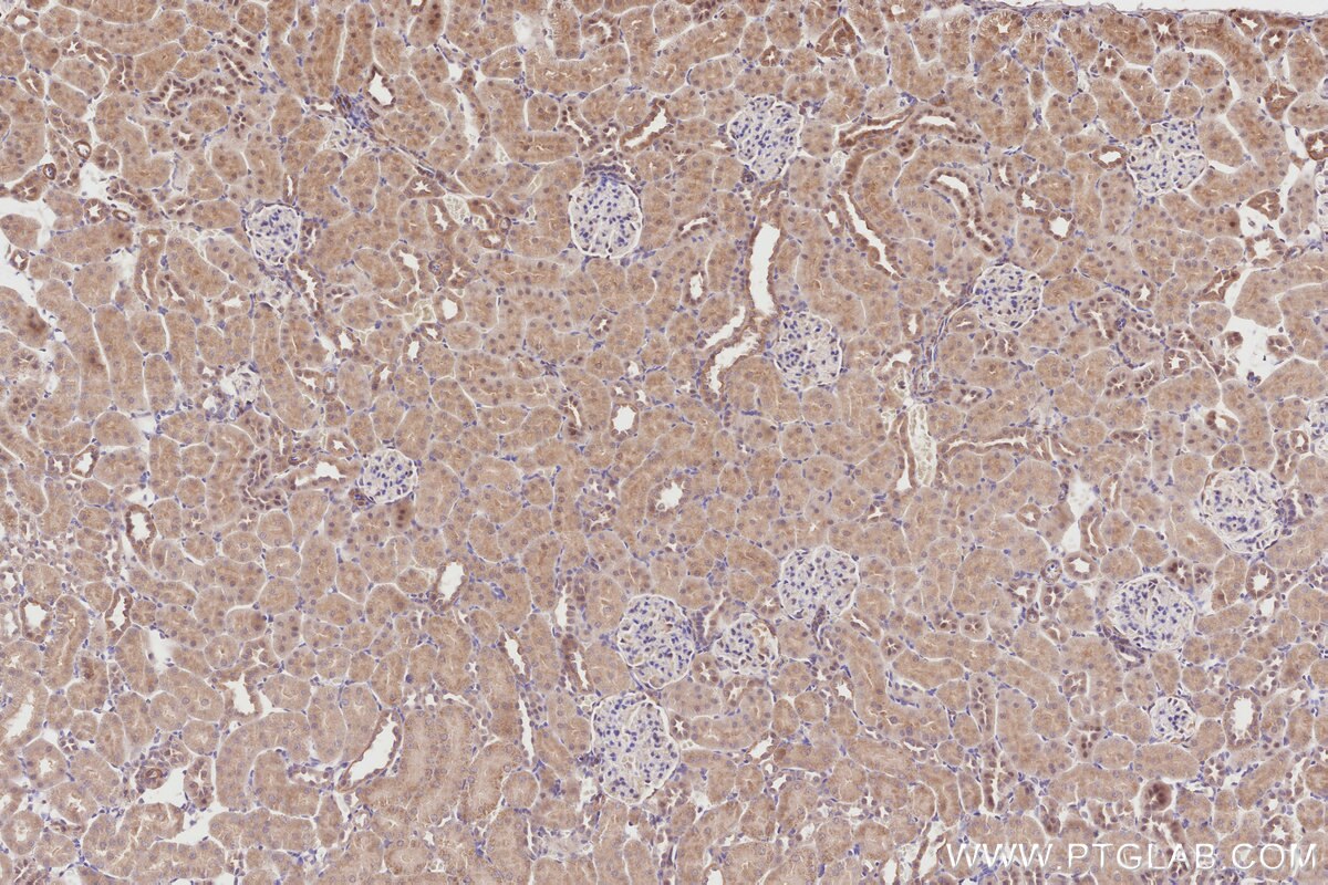 Immunohistochemical analysis of paraffin-embedded rat kidney tissue slide using KHC2860 (TRIM56 IHC Kit).