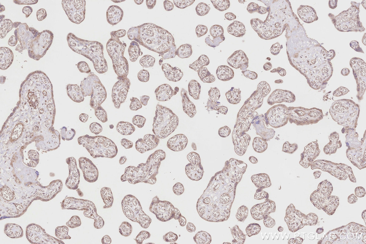 Immunohistochemical analysis of paraffin-embedded human placenta tissue slide using KHC2860 (TRIM56 IHC Kit).