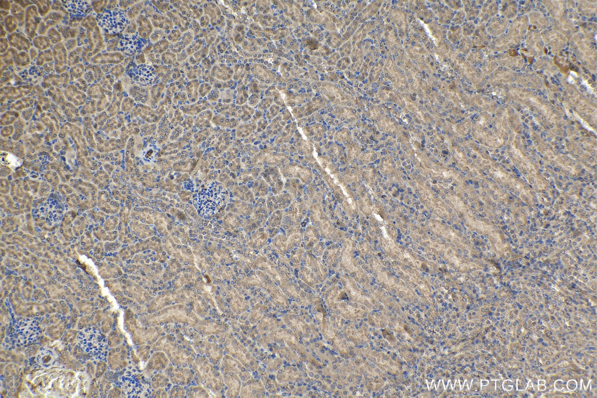 Immunohistochemical analysis of paraffin-embedded mouse kidney tissue slide using KHC1173 (TRIM59 IHC Kit).