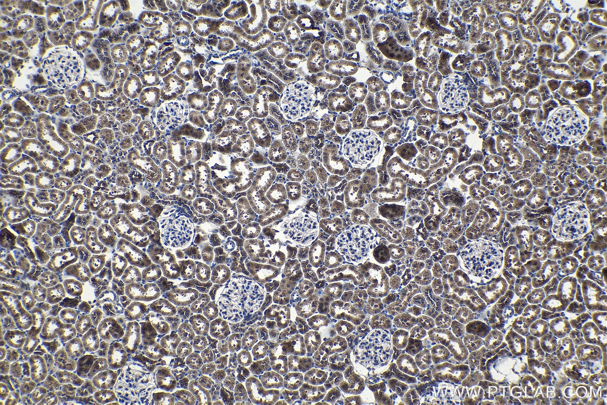 Immunohistochemical analysis of paraffin-embedded rat kidney tissue slide using KHC1173 (TRIM59 IHC Kit).