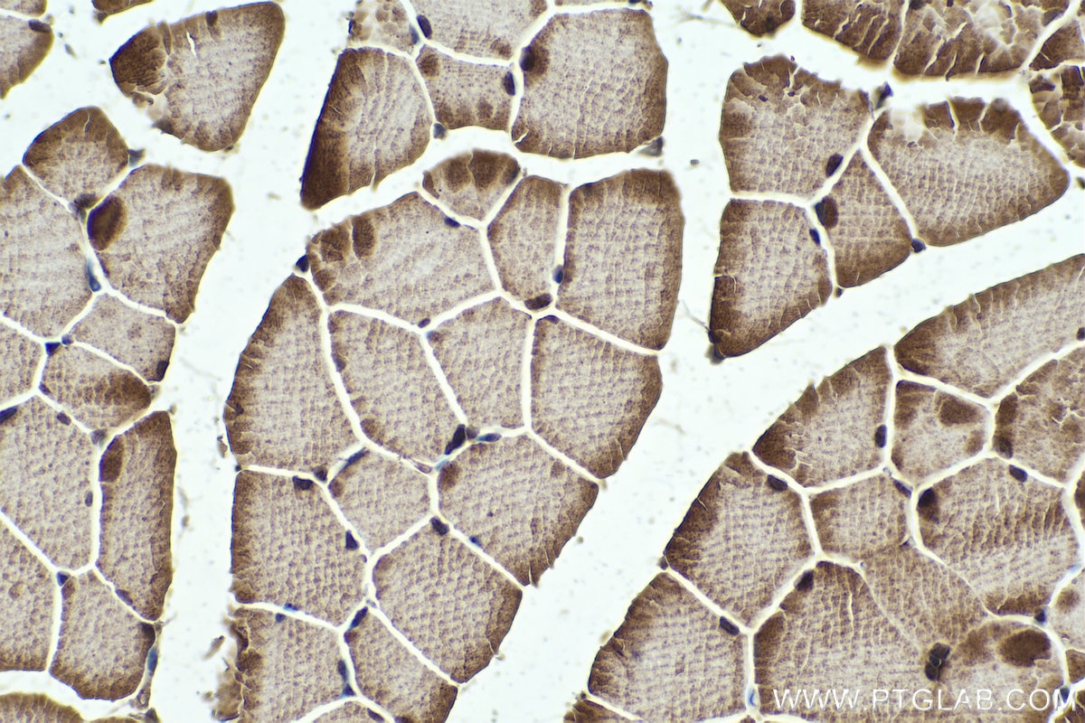 Immunohistochemical analysis of paraffin-embedded mouse skeletal muscle tissue slide using KHC0330 (TRIM63 IHC Kit).