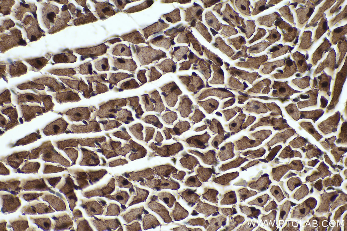 Immunohistochemical analysis of paraffin-embedded mouse heart tissue slide using KHC0330 (TRIM63 IHC Kit).