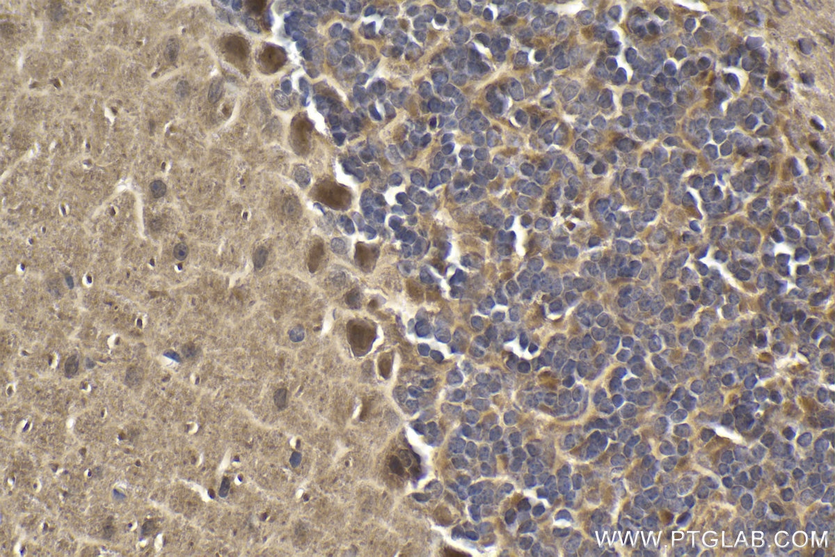 Immunohistochemical analysis of paraffin-embedded mouse cerebellum tissue slide using KHC1912 (TRIM8 IHC Kit).