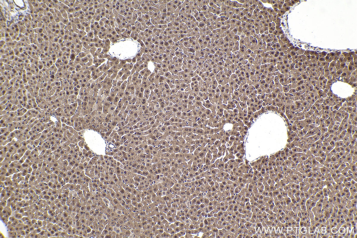 Immunohistochemical analysis of paraffin-embedded mouse liver tissue slide using KHC1912 (TRIM8 IHC Kit).