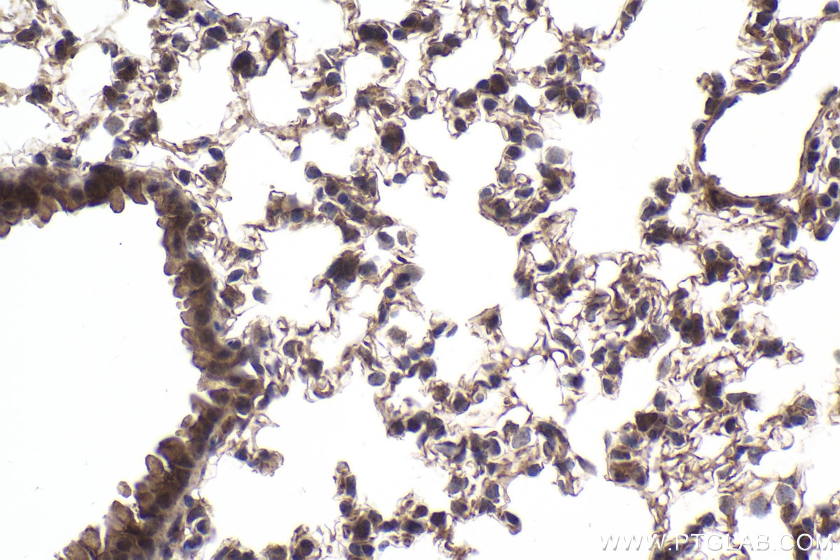 Immunohistochemical analysis of paraffin-embedded mouse lung tissue slide using KHC1912 (TRIM8 IHC Kit).