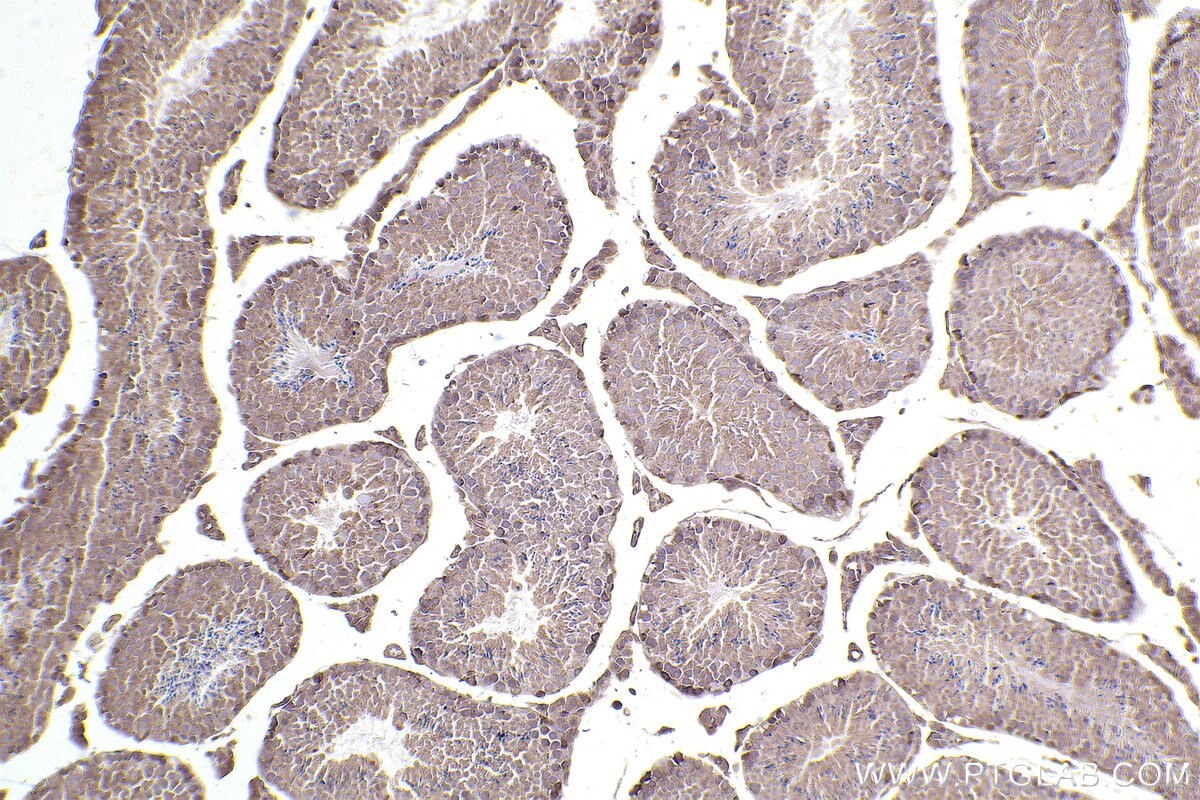 Immunohistochemical analysis of paraffin-embedded mouse testis tissue slide using KHC2493 (TRIP10 IHC Kit).