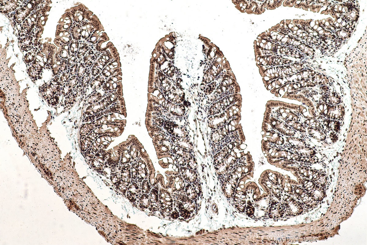 Immunohistochemical analysis of paraffin-embedded mouse colon tissue slide using KHC0989 (C19orf43 IHC Kit).