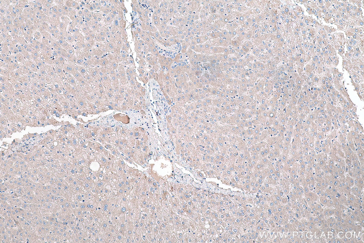 Immunohistochemical analysis of paraffin-embedded human liver tissue slide using KHC0178 (TRMT61B IHC Kit).