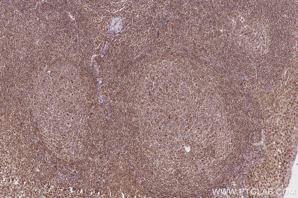 Immunohistochemical analysis of paraffin-embedded human tonsillitis tissue slide using KHC2818 (TRNT1 IHC Kit).