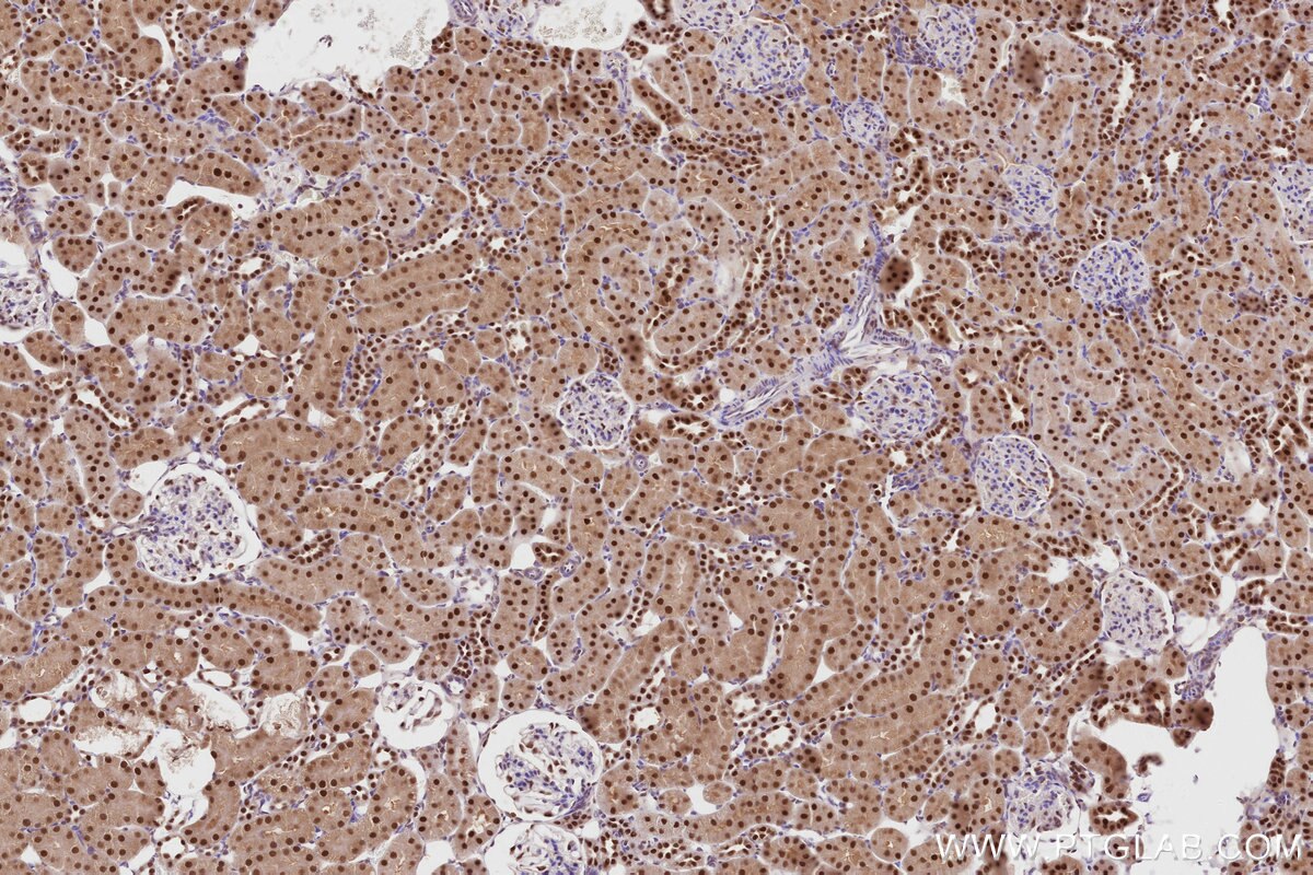 Immunohistochemical analysis of paraffin-embedded rat kidney tissue slide using KHC2818 (TRNT1 IHC Kit).