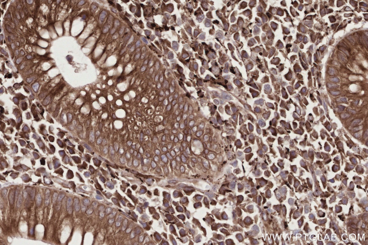 Immunohistochemical analysis of paraffin-embedded human appendicitis tissue slide using KHC2723 (TRPC4AP IHC Kit).