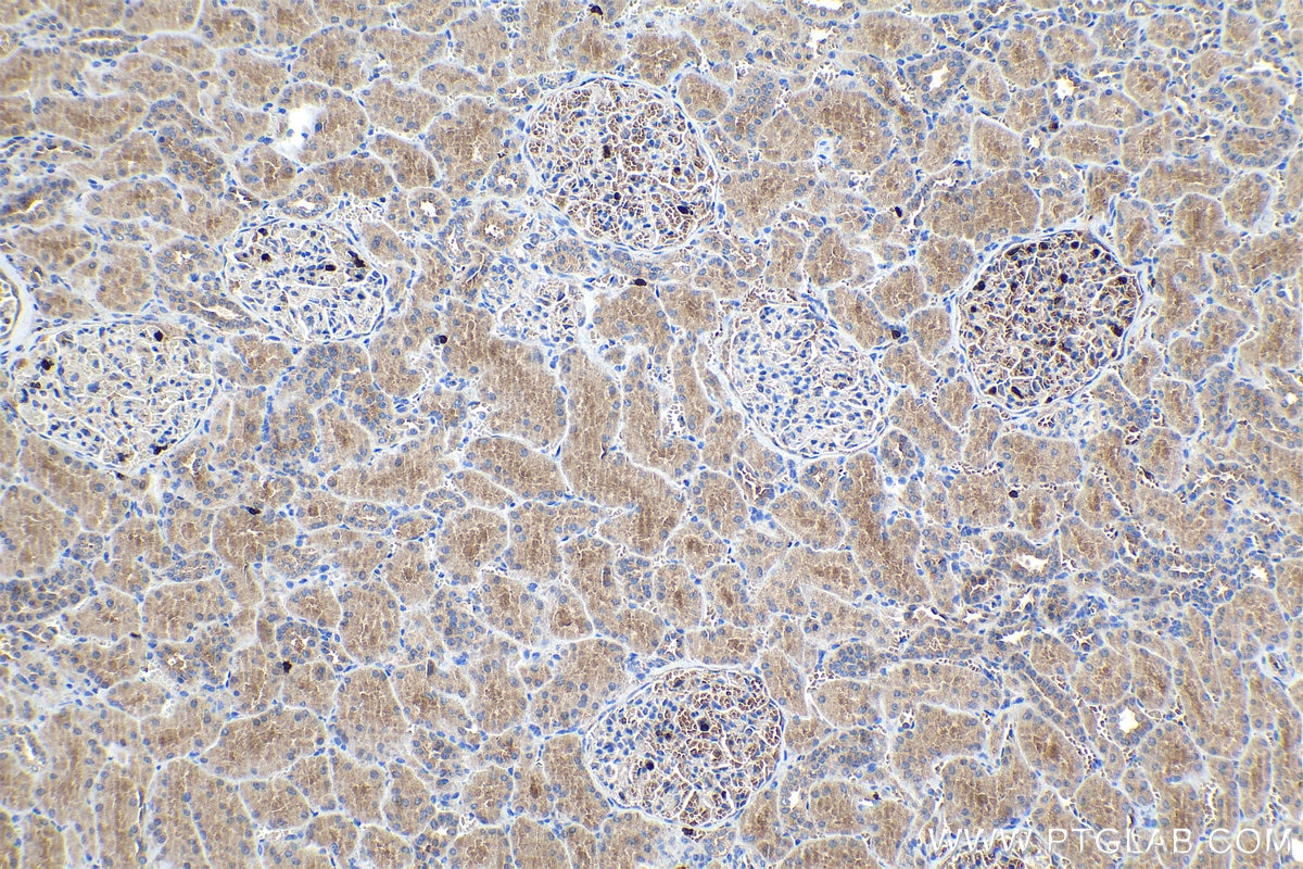 Immunohistochemical analysis of paraffin-embedded human kidney tissue slide using KHC1060 (TSC1 IHC Kit).