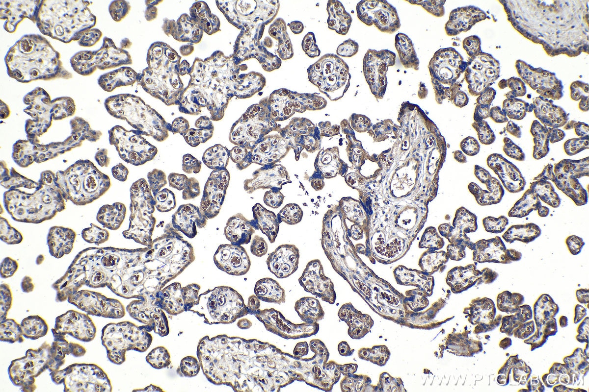 Immunohistochemical analysis of paraffin-embedded human placenta tissue slide using KHC1060 (TSC1 IHC Kit).