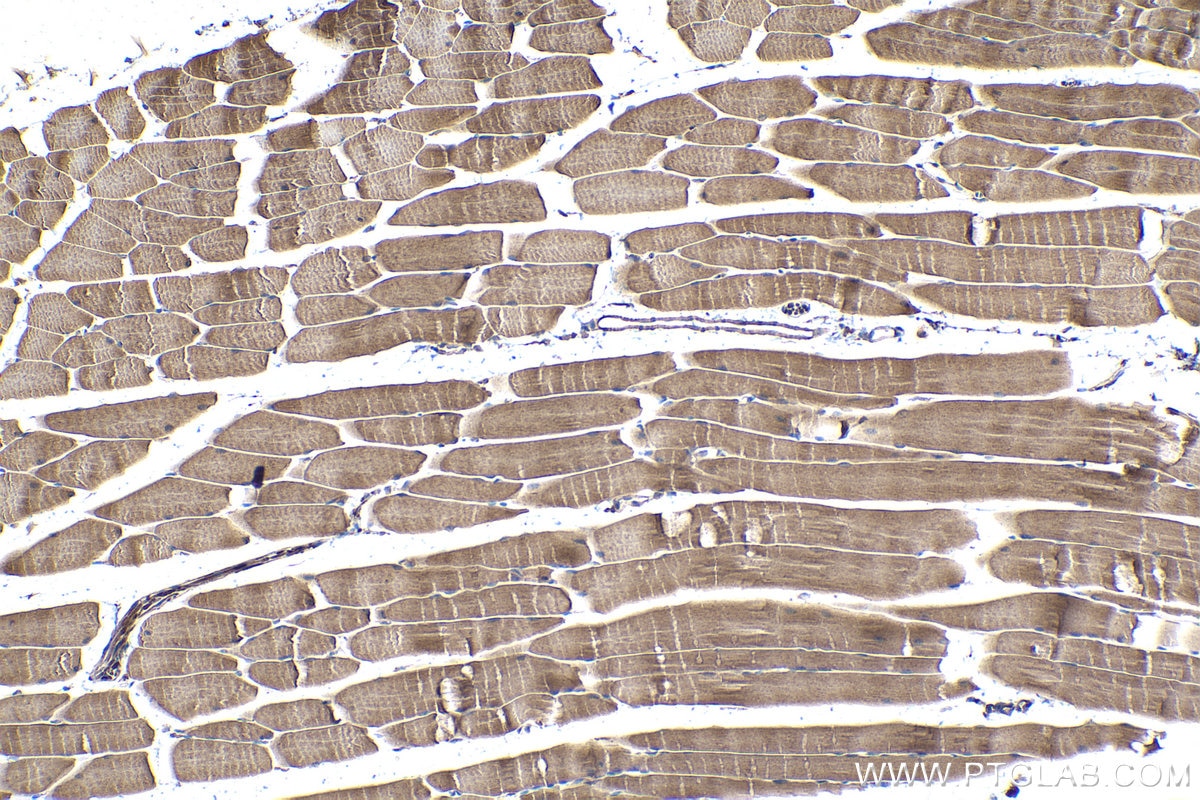 Immunohistochemical analysis of paraffin-embedded mouse skeletal muscle tissue slide using KHC1060 (TSC1 IHC Kit).