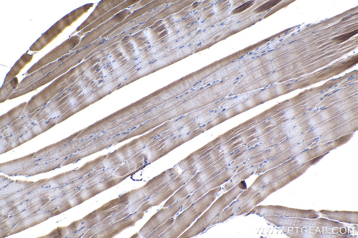 Immunohistochemical analysis of paraffin-embedded rat skeletal muscle tissue slide using KHC1060 (TSC1 IHC Kit).