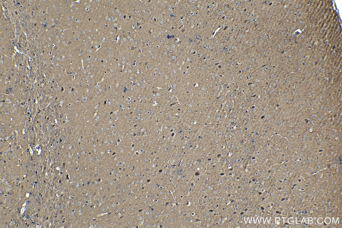 Immunohistochemical analysis of paraffin-embedded mouse brain tissue slide using KHC1341 (TSC22D1 IHC Kit).