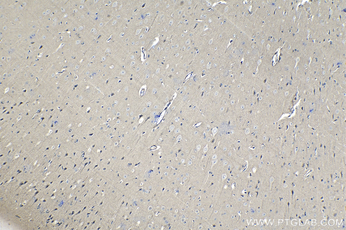 Immunohistochemical analysis of paraffin-embedded rat brain tissue slide using KHC1341 (TSC22D1 IHC Kit).