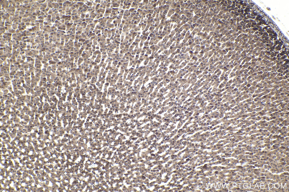 Immunohistochemical analysis of paraffin-embedded rat adrenal gland tissue slide using KHC1891 (TSC22D3/GILZ IHC Kit).