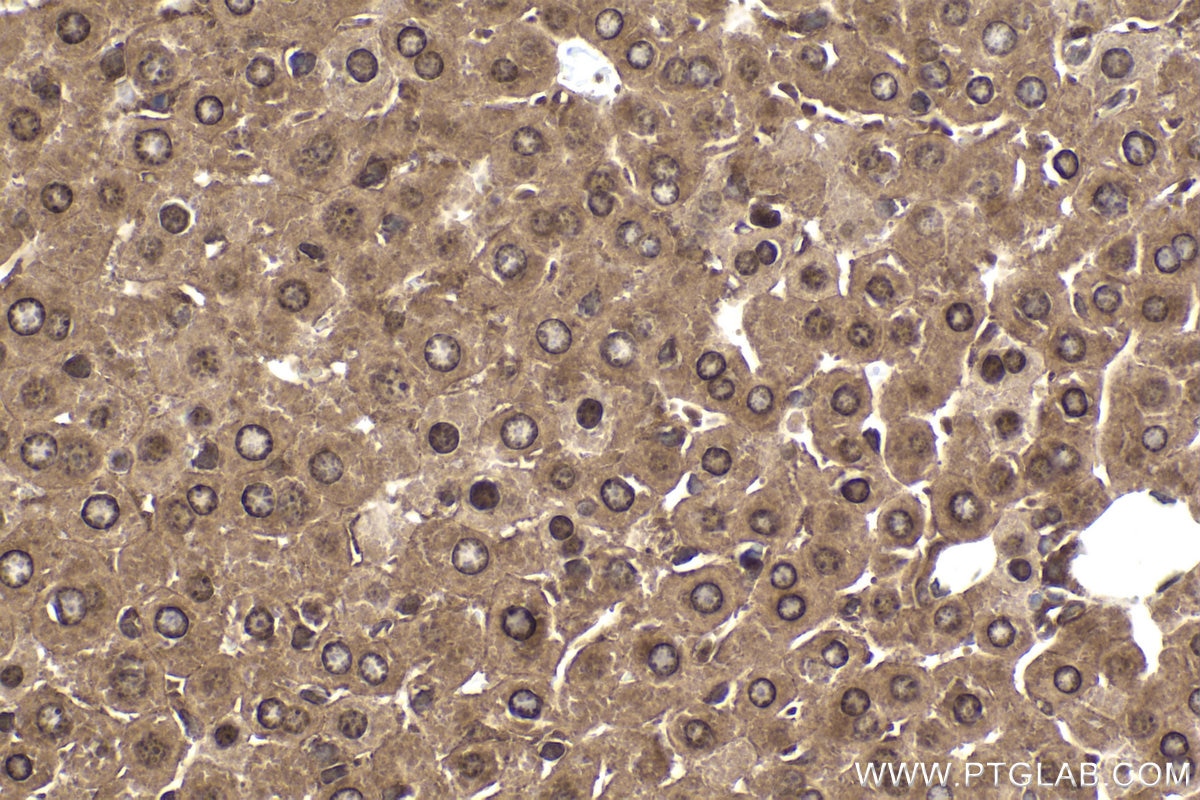 Immunohistochemical analysis of paraffin-embedded mouse liver tissue slide using KHC1897 (TSG101 IHC Kit).