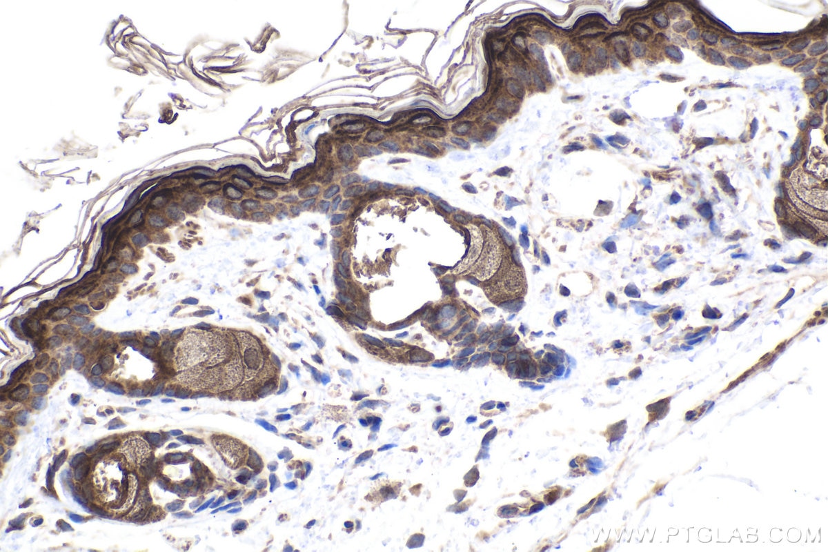 Immunohistochemical analysis of paraffin-embedded mouse skin tissue slide using KHC1897 (TSG101 IHC Kit).